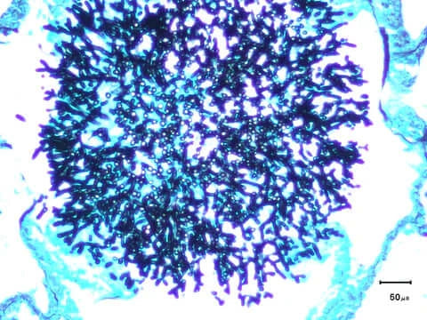 Microscopic image of fungus